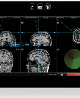 Beyin Cerrahi  NöroNavigasyon